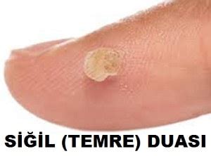 Arpayla Siğil Duası: Neden Okunmalıdır?